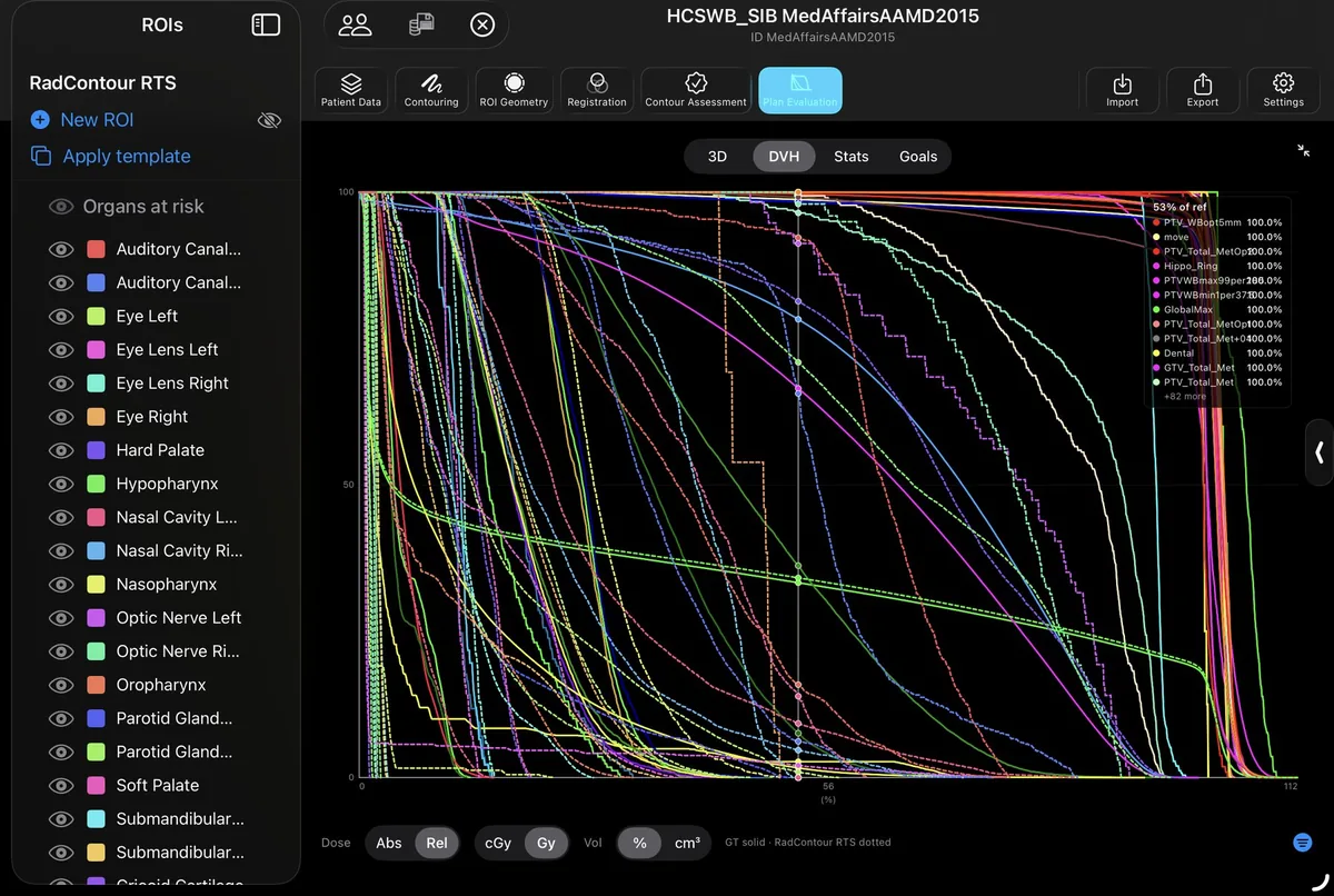 RadContour's DVH view comparing dose-volume histograms of every structure: expert ground-truth contours drawn solid, RadContour structure set dotted.