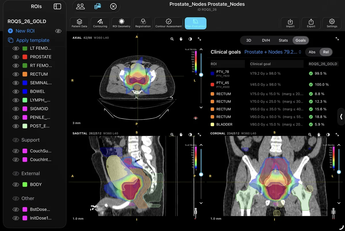 RadContour's clinical goals view on a prostate plan: dose wash over three CT planes and a checklist of per-structure dose-volume goals, each marked as passing.